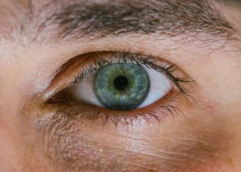 dark circles under eyes