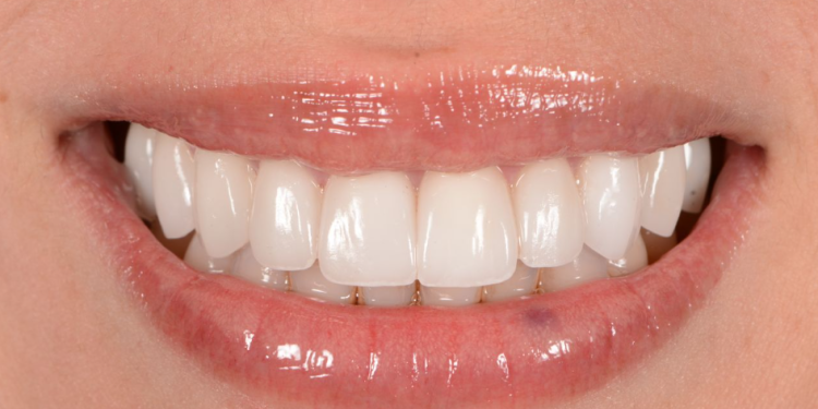 What it’s really like being a leading cosmetic dentist in today’s image-obsessed world